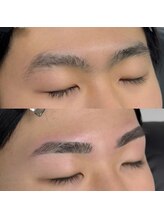 ブリス 姫路(Bliss)/お客様Before/After