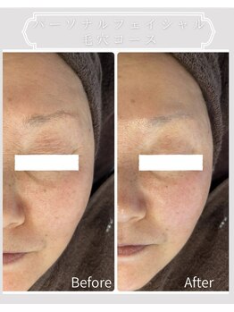 グラサヴォーグ 金沢店/パーソナルフェイシャル