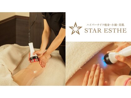 スターエステ(STAR ESTHE)の写真