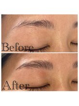 マンケイブ(MAN CAVE)/施術事例