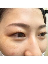 ビューティフェイス ビューティアイラッシュ 岡山天満屋店(BeautyFace Beautyeyelash)/セットでお得＆キレイに【岡山】