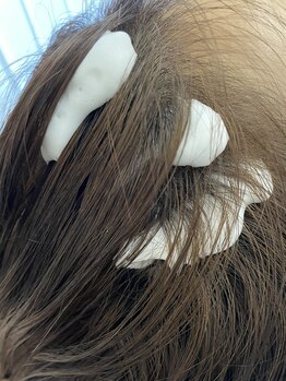 ラペカ(Lapeca)/強髪/育毛促進頭皮ケア/白髪改善