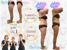 アリーズエステスウェイ 豊田店の雰囲気（口コミ高評価★嬉しいサイズダウンのお声は口コミをご覧下さい★）