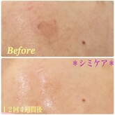 ラボーテ(La Beaute)