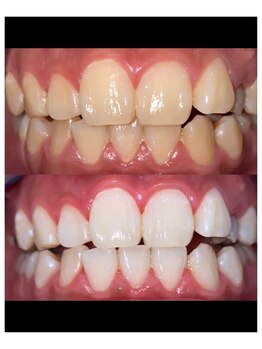 プラチナムビューティー 横須賀店/ビフォーアフター