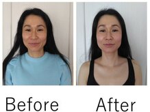 マホロ(MAHORO)/40代女性　ビフォー＆アフター