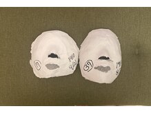 シャインビューティー(ShineBeauty)/石膏パックビフォーアフター写真