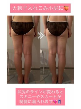 ラナ 京都西院店(Lana)/脚むくみスッキリ＆小尻に