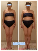 小顔コルギ専門店 フェルーシュ 成田駅前店(Feruche)/背中+下半身コルギ