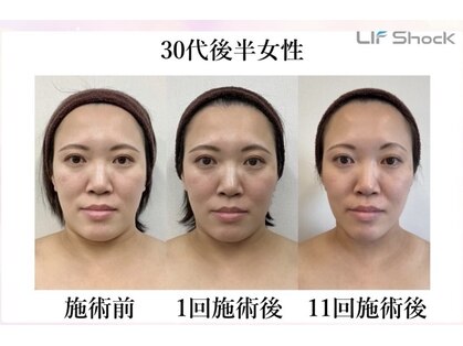 サンスタイルクリア 守山店(SUN STYLE CLEAR)の写真
