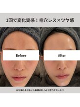 エムビューティーサロン(M Beauty Salon)