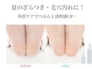 スパルーチェ足裏角質ケア★