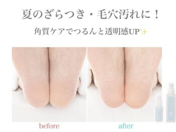スパルーチェ足裏角質ケア★