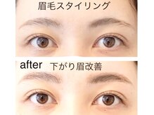 ハピネス(Happiness)/【下がりまゆ】改善しました。