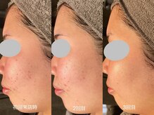 サロン デ ミロ(Salon de Miro)/BeforeAfter多数！ブログへGO♪