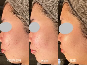 サロン デ ミロ(Salon de Miro)/BeforeAfter多数！ブログへGO♪