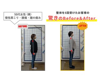 にこにこ整体 整骨院/【腰痛・肩こり】整体をBE⇒AF