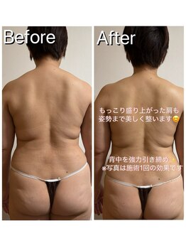 サロン ド ブラン(Salon de Blanc)/お背中徹底ケア!