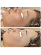 ラディエンス 多治見店/リアボーテマーメイドセルエステ