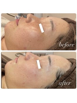 ラディエンス 多治見店/リアボーテマーメイドセルエステ