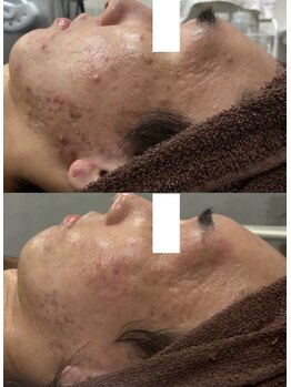 ダリアビューティー(Dahlia Beauty)/組み合わせメニューBefore After