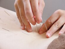 健康堂 荏原町院の雰囲気（全スタッフ国家資格者！鍼灸メニュー有♪）