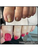 福屋/巻き爪ケアもお任せ♪