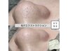 【黒ずみ毛穴改善】毛穴洗浄でつるんとノーファンデ肌へ