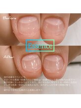 エッセンス (Essence)/深爪、二枚爪対策におすすめ♪
