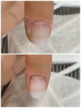 リフレシア(Rifrecia)/指先、爪周りのケア