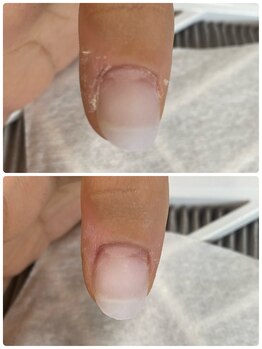 リフレシア(Rifrecia)/指先、爪周りのケア