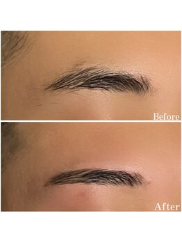 眉毛男子 新宿店/before/after