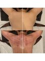 エクラ(eclat)&nbsp;大人気セルクラ！肩こり解消はもちろん、体全体サイズダウン！