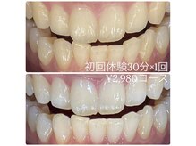 ホワイトニングルーム 横浜店(Whitening Room)/セルフホワイトニング/横浜