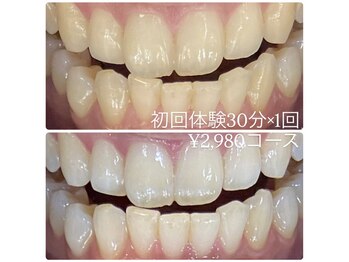 ホワイトニングルーム 横浜店(Whitening Room)/セルフホワイトニング/横浜