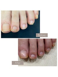 フットネイルケア☆