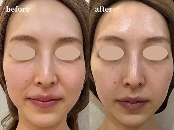 クレールアンジュ(ClairAnge)/老け顔が気になる方