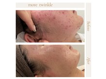 モアトゥインクル 五日市駅前店(MORE twinkle)