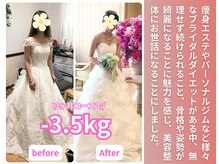 美容整体院アサシ 上尾院(美容整体院ASASHI)/20代ブライダル実績(痩身/整体)