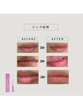 シューラディアント 金沢店(ShuRadiant)/ローマピンク【唇】