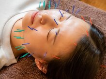 あいあい整骨院 古京町院/美容鍼　肌質改善・リフトアップ