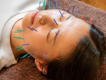 あいあい整骨院 古京町院/美容鍼 肌質改善・リフトアップ