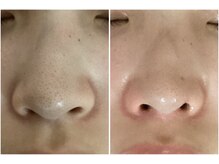 アイズ 横浜店(ize)/