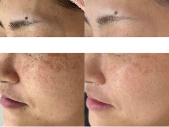 サクラ 本厚木駅前店(SAKURA)/【本厚木/相模原/伊勢原/秦野】