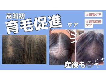 ミライ(Mirai)/抜け毛ケア