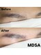 エムディーエスエー(MDSA)の写真/お手入れ不要の眉毛を目指すなら電気脱毛！デザイン込みでも、他店デザインで生えてきた眉もお任せ下さい♪