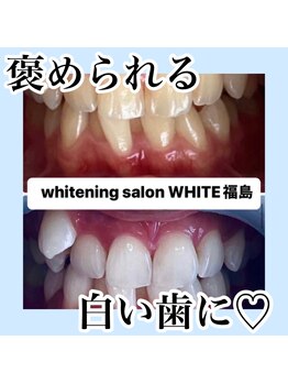 ホワイトニングサロン ホワイト(WHITE)/褒められる白い歯に！