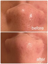 シャインクラフト/