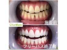 ルブラン 奈良店(Le Blanc)/本来の歯のお色に！