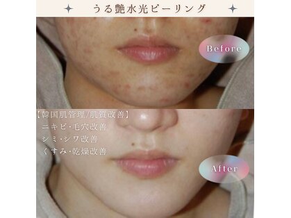 ミューベル(MYubelle)の写真